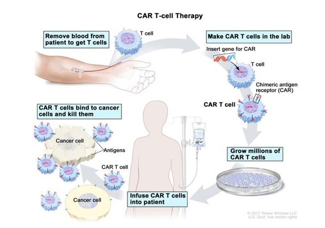 CAR-T cell technology gives hope for cancer treatment